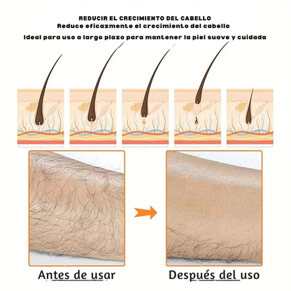 Depiladora SmoothTouch Crystal