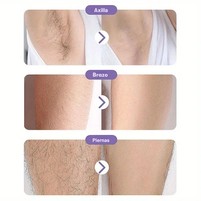 Depiladora SmoothTouch Crystal