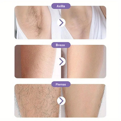 Depiladora SmoothTouch Crystal