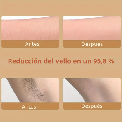 Depiladora SmoothTouch Crystal