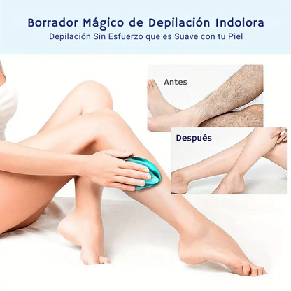Depiladora SmoothTouch Crystal